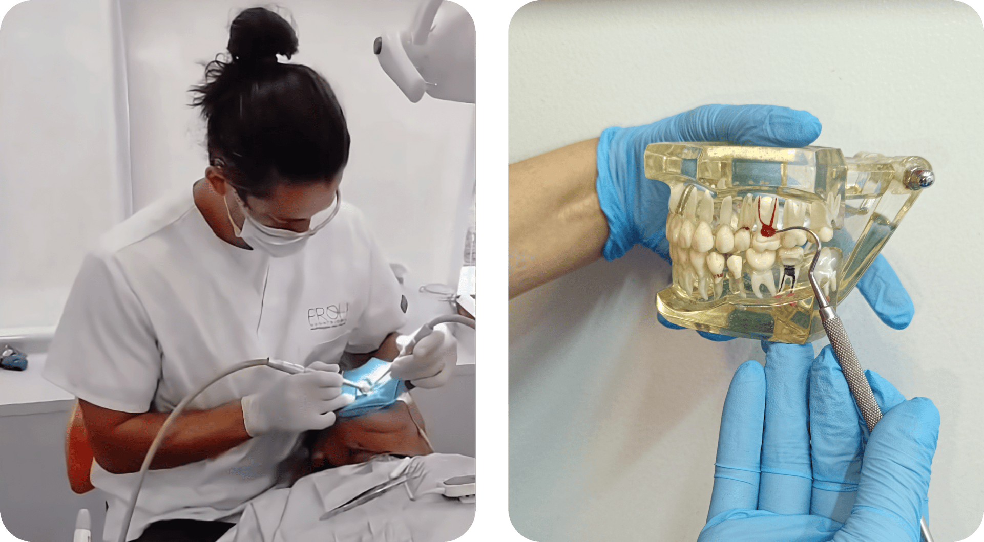 Blanqueamiento dental